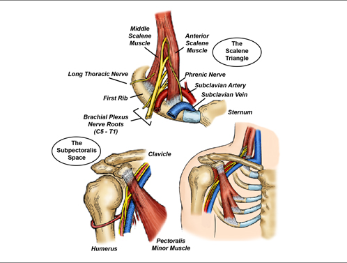 Assessment of thoracic outlet syndrome